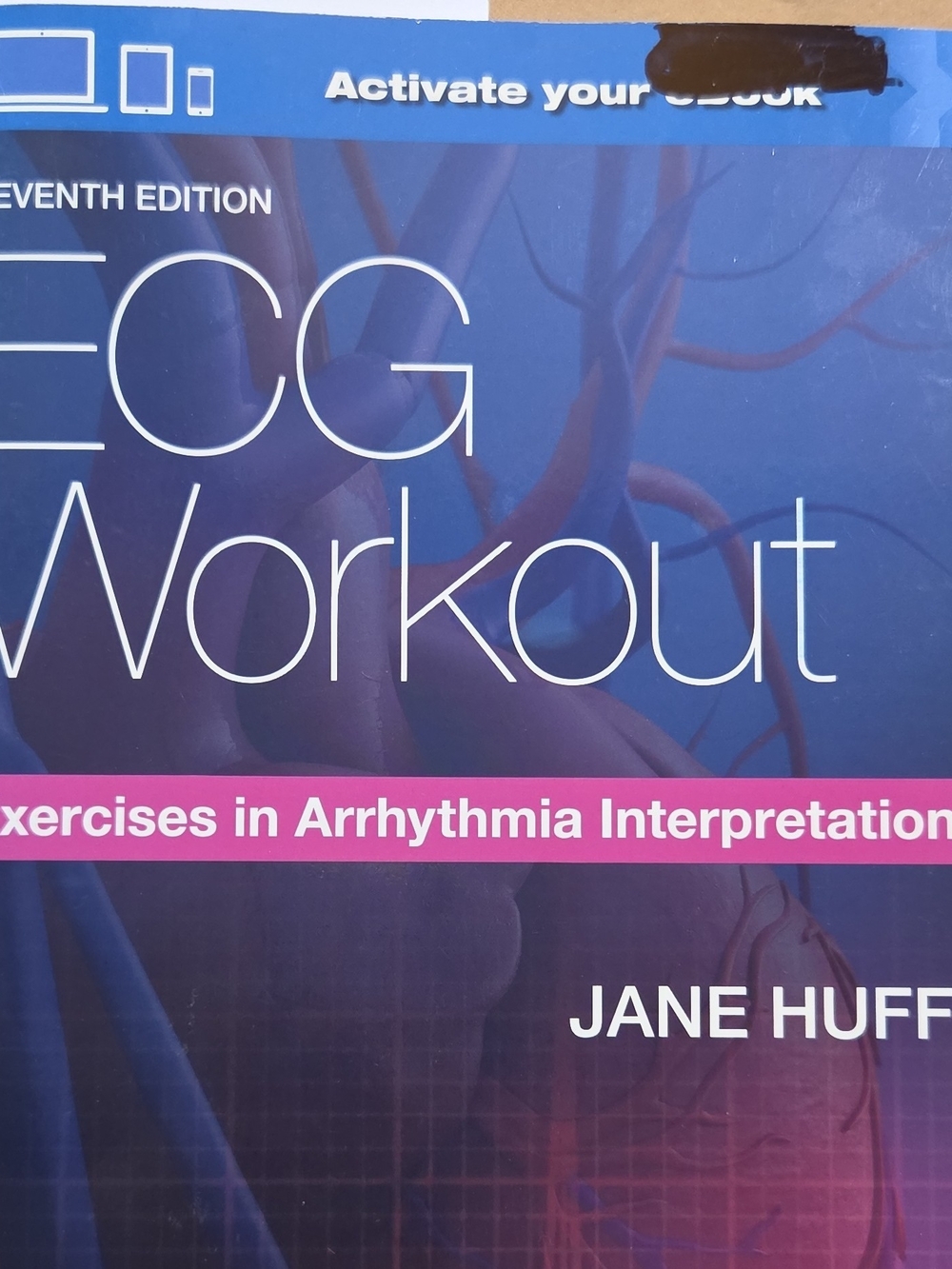 Wolters Kluwer ECG Workout Arrhythmia Interpretation 7th PB Huff 2017 ISBN